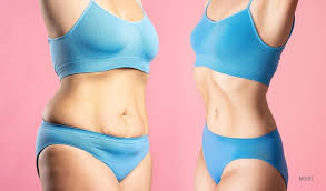 Bay Area Plastic Surgery